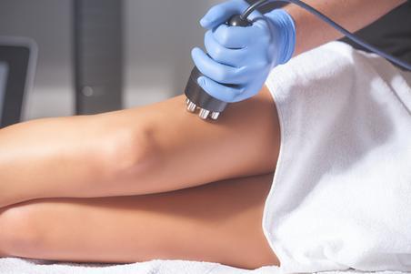 Woman receiving cellulite treatment on legs
