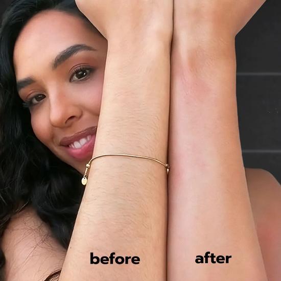 Answr Exfoliating Hair Removal Drop