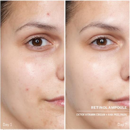 BABOR Ampoules Retinol Power Serum 7 x 2ml