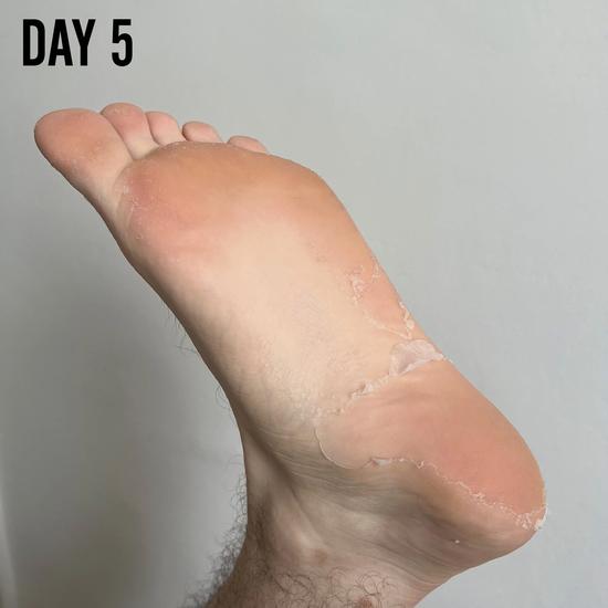 BARBER PRO FOOT PEEL