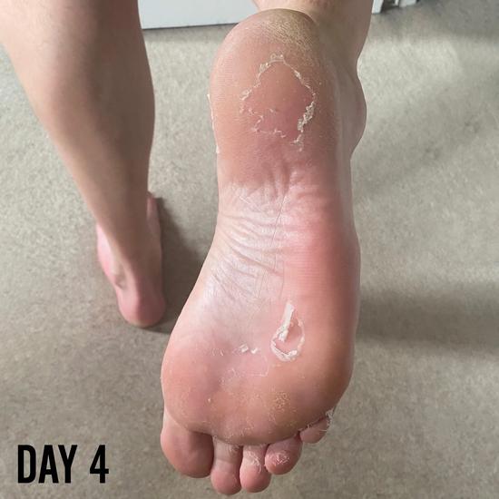 BARBER PRO FOOT PEEL