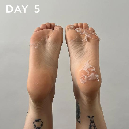 BeautyPro FOOT & CALLUS PEEL With Over 16 Botanical & Fruit Extracts