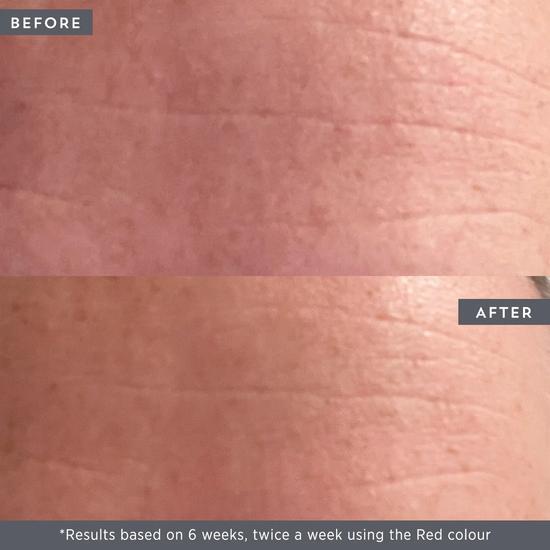 BeautyPro LED Wand 5 In 1 Anti-Ageing Device