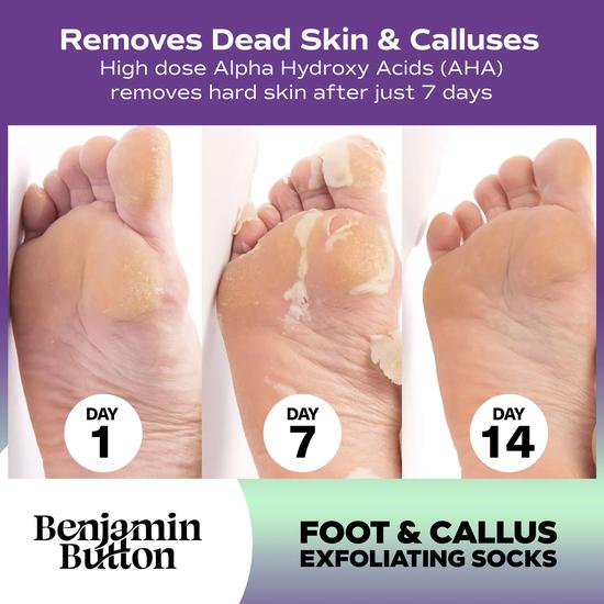 Benjamin Button Exfoliating Foot Mask x 1