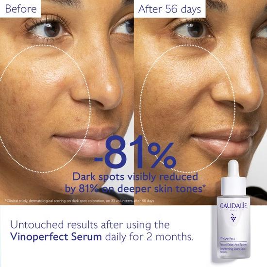 Caudalie Vinoperfect Brigahtening Dark Spot Serum 50ml