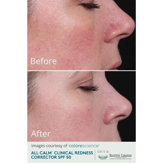 Colorescience All Calm Clinical Redness Corrector SPF 50 30ml