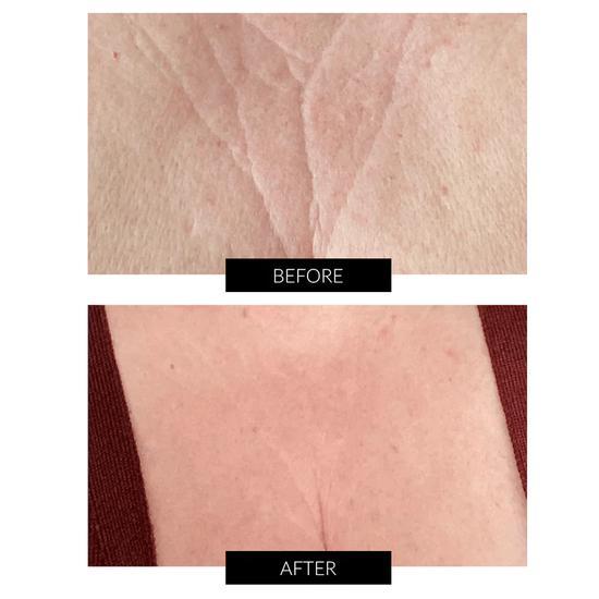 CurrentBody Skin LED Neck & Dec Perfector