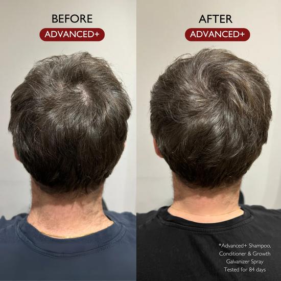 Daimon Barber Advanced+ Hair Growth Galvanizer