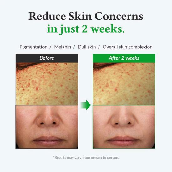 Dr. Althea Gentle Vitamin C Serum 30ml