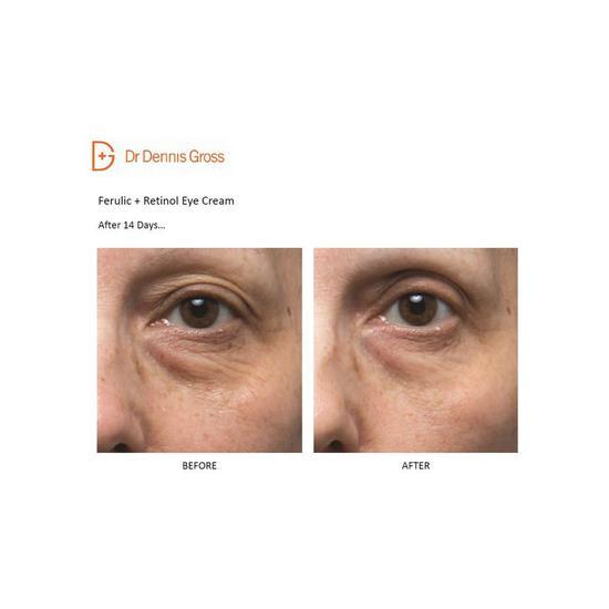 Dr Dennis Gross Skincare Ferulic & Retinol Eye Cream