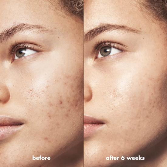 e.l.f. Blemish Breakthrough Clarifying Cleanser 115ml