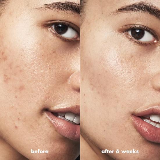 e.l.f. Blemish Breakthrough Clarifying Cleanser 115ml