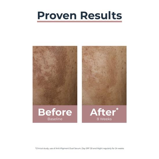 Eucerin Anti-Pigment Perfector Night Care 50ml