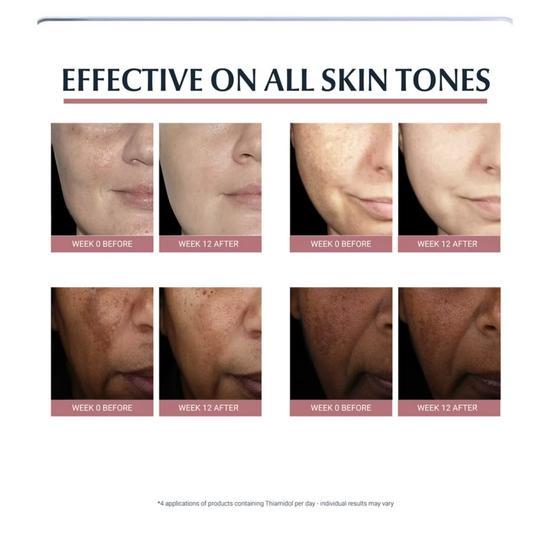 Eucerin Anti-Pigment Spot Corrector 5ml