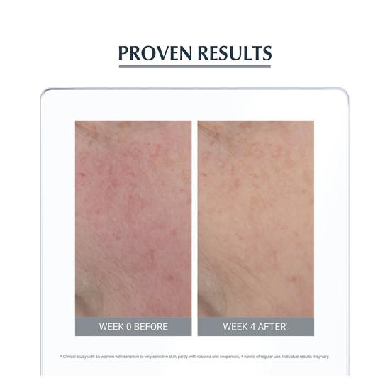 Eucerin Anti-Redness Soothing Care Cream 50ml