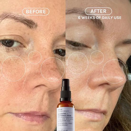 Evolve Beauty Resveratrol + Niacinamide Serum 30ml