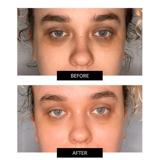 FaceGym Faceshot Electric Microneedling Device