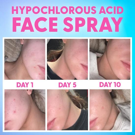 Give Me Hypochlorous Acid Face Spray