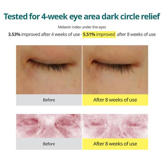 Goodal Green Tangerine Vitamin C Dark Circle Eye Cream 30ml