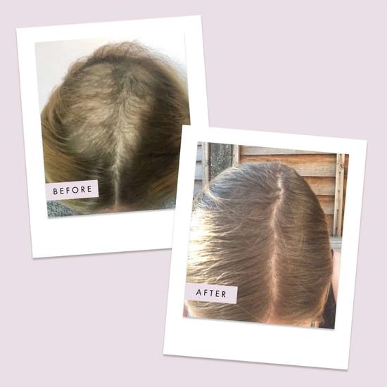 Hair Gain Capsules Month Supply 1 Capsules