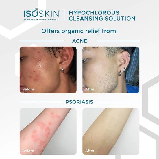 ISOCLEAN Hypochlorous Spray 165ml