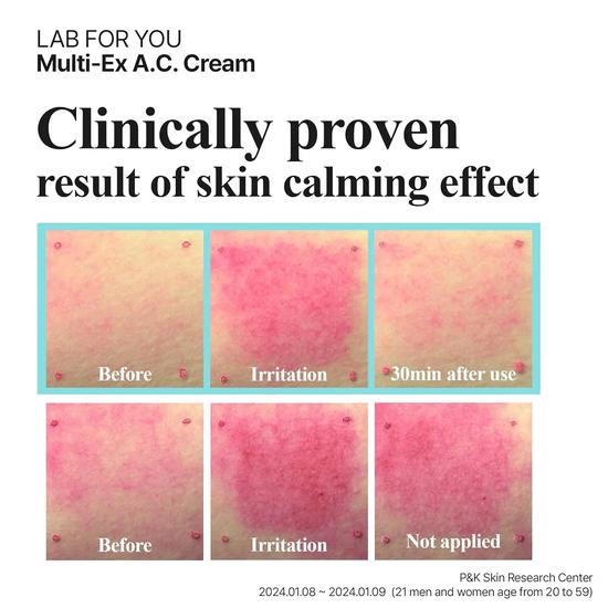 LAB FOR YOU Multi-Ex A.C. Cream Blemish Relief Acne-prone Skin Spot Treatment Gel 20ml