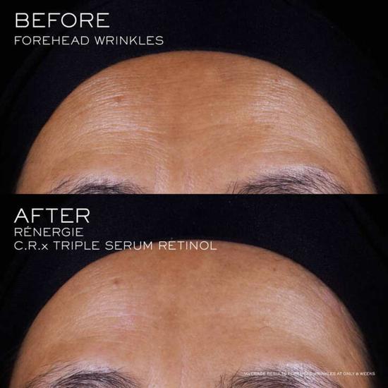 Lancôme Renergie C.R.x Triple Serum Retinol 20ml
