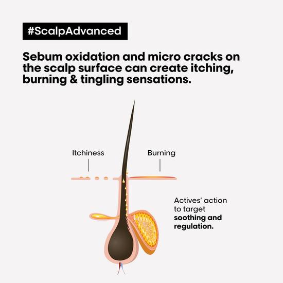 L'Oréal Professionnel Serie Expert Scalp Advanced Anti-Discomfort Intense Soother Treatment 200ml
