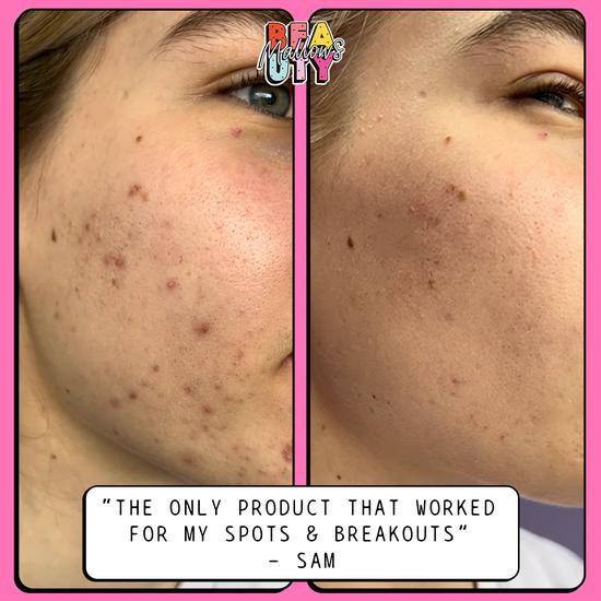 Mallows Beauty Pineapple Enzyme Peel Mask Sachet