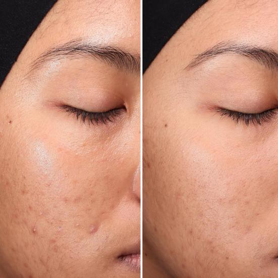 Medik8 Press & Clear Refill: 150ml