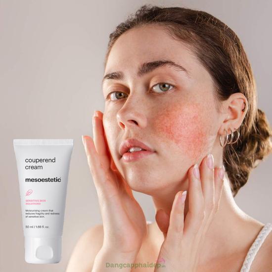 Mesoestetic Couperend Cream 50ml