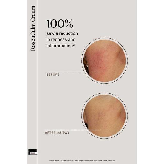 NAYA Calm Me RoseaCalm Cream 5ml