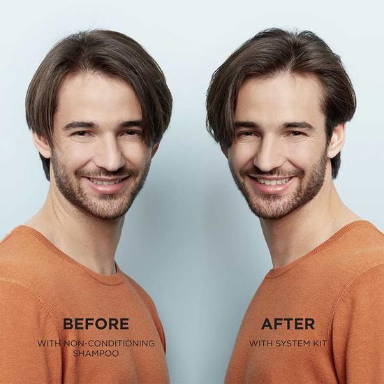 Nioxin System 2 Scalp & Hair Treatment 100ml