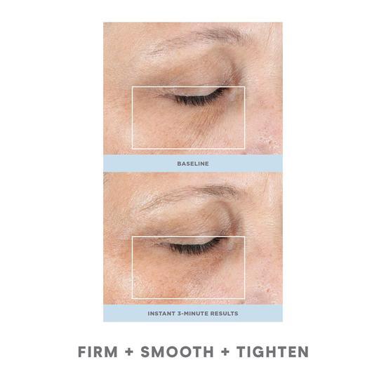 NuFACE FIX Line Smoothing Device