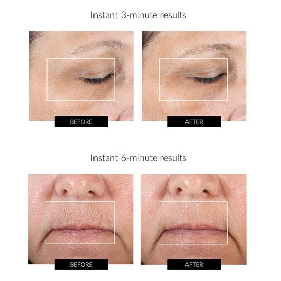 NuFACE Fix Magical Results Smooth and Tighten Kit