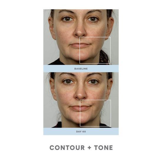 NuFACE Trinity Magical Results Firm + Brighten Kit