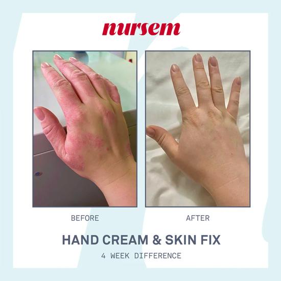 Nursem Skin Care Discovery Set