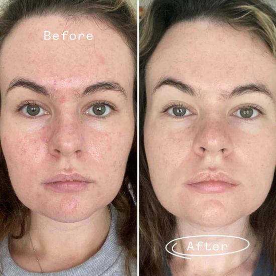 Pai Carbon Star Detoxifying Overnight Face Oil