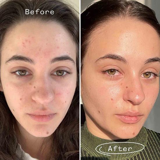 Pai Carbon Star Detoxifying Overnight Face Oil
