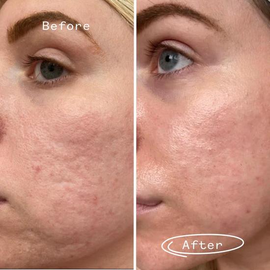 Pai Hyaluronic Acid Booster 0.3% 10ml
