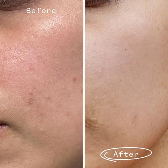 Pai Hyaluronic Acid Booster 0.3% 10ml