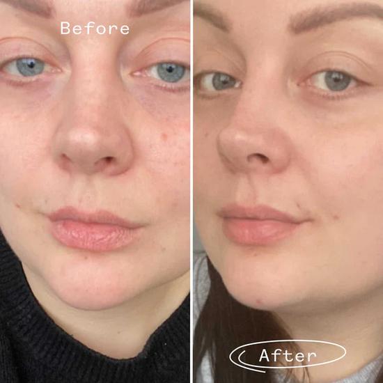 Pai Rosehip BioRegenerate Oil