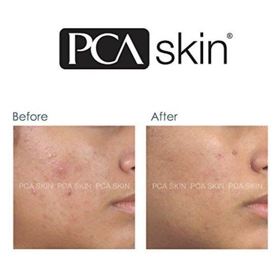 PCA SKIN Blemish Control Bar 90g