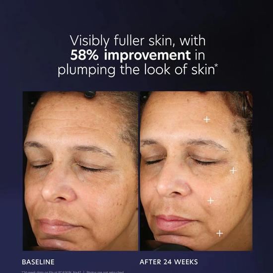 PCA SKIN Pro-Max Age Renewal Serum