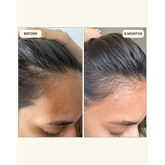 Resèt Invigorating Hair & Scalp Oil 100mL