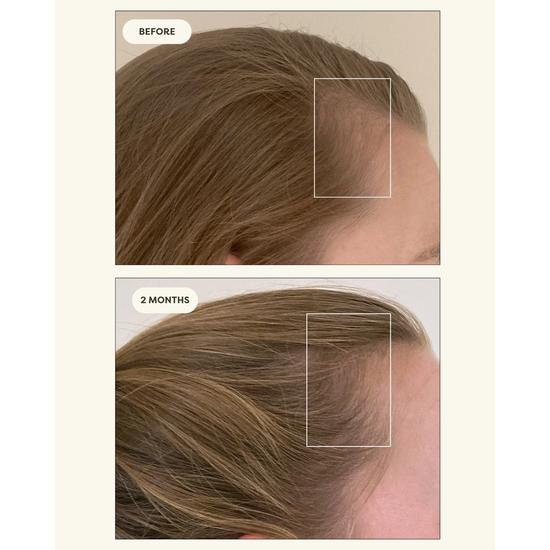 Resèt Stimulating Scalp Serum 50mL