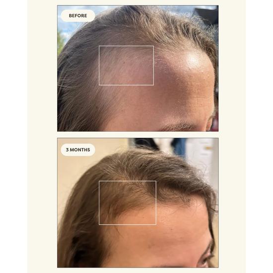 Resèt Stimulating Scalp Serum 50mL