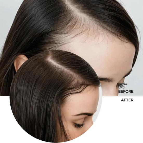 Revox B77 Just Multi Peptides Hair Density Serum 30ml