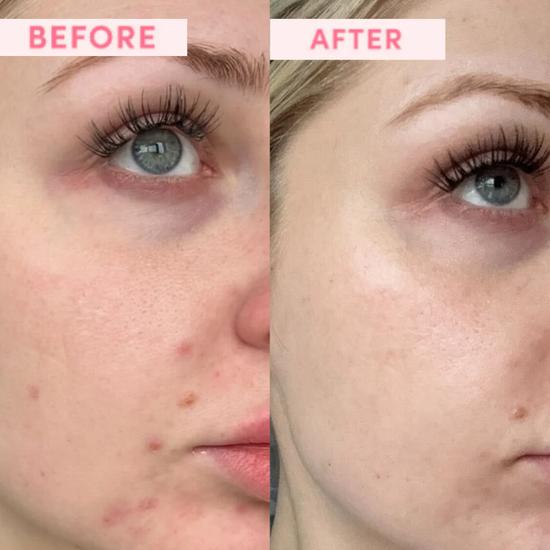 Sand & Sky Resurfacing Face Mask 80g