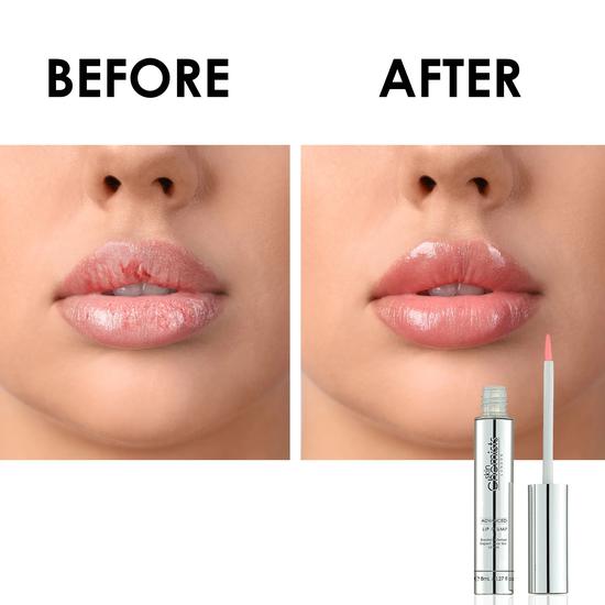 skinChemists Advanced Lip Plum Plumper 8ml